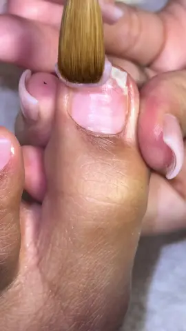 big toe application in real time 😍