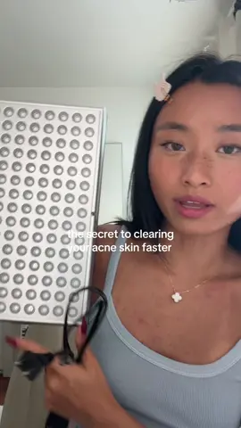 i was using this last might while watching love island LOL but this does help my acne significantly it makes it feel calmer 🫶 #acne #acneproneskin #acnesjourney #acnetreatment  @omniluxled led mask  @Shark Beauty 