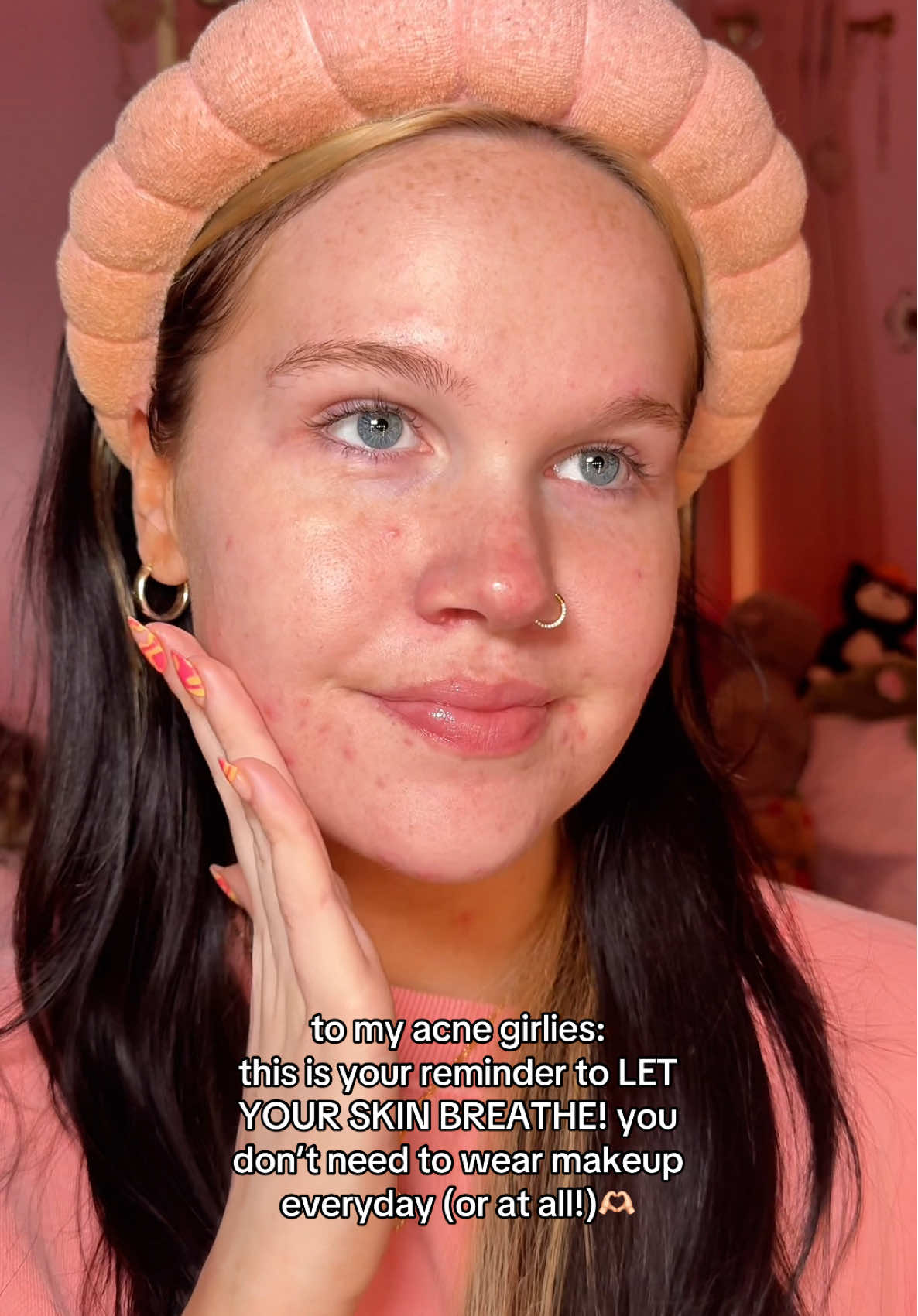 no funky friday makeup challenge for today💔 my skin is letting me know that it needs the day to breathe, and that’s okay💖 @Caudalie @laneige_us @LaRochePosayUS @Babe Original  #acne #acnetreatment #acneproneskin #acnescars #acneskincare #relateable #pcos #pcosawareness #thisisyoursign #selflove #makeup #acneflareup #skincare #skincareroutine #skincaretips #acnetips 