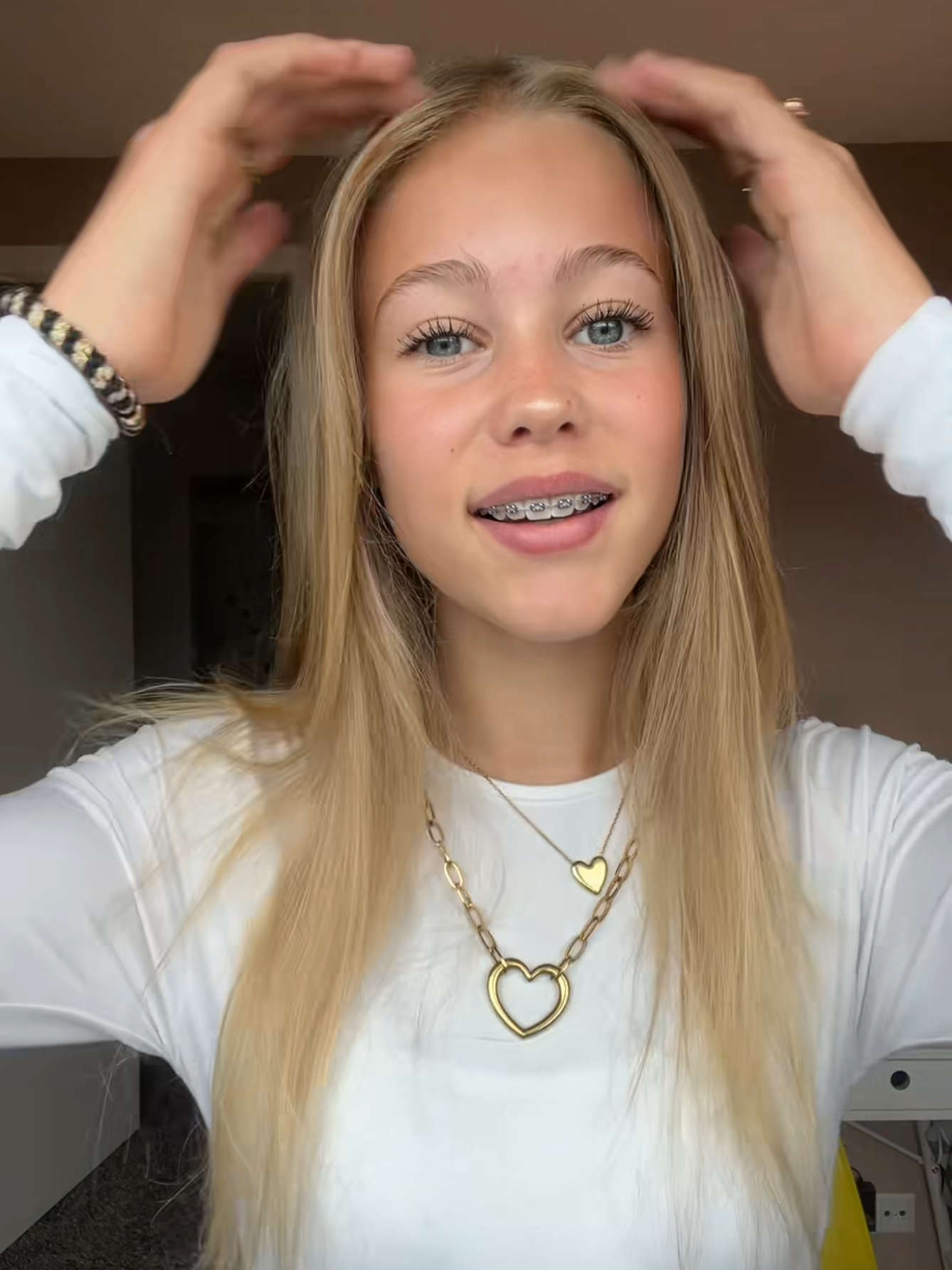 #blueeyes #blonde #braces #bracesgirl #beauty #girl #cutie #lipsync #lipstick  @⭐️⭐️ 