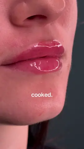 THE BEST PUSH PRESENT EVER. #lipfiller #lipflip #poutaesthetics #phillylipfiller @POUT AESTHETICS 