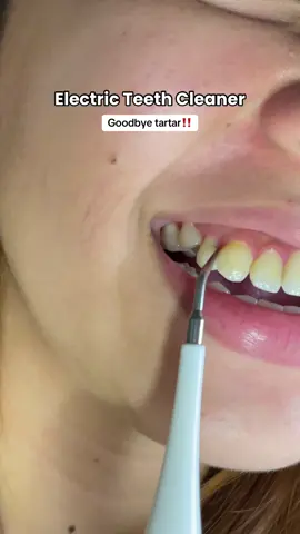 Legit Electric Teeth Cleaner set from @YIZOUYU.PH #electric #electricteethcleaner #electricteethcleaningtools #electricteethbrush #oralcare #cleaningbrush #cleaninghack #cleaningteeth #teethcleaner #teethcleaning #teethcleaningcheckup #tartar #tartarremoval #tartarremover #deals #dealsforyouday #paydaysale #reynapro #tiktokph #tiktokmademebuyit #tiktokmademebuythis #fyp #budol #budolfinds #tiktokbudol #tiktokph 