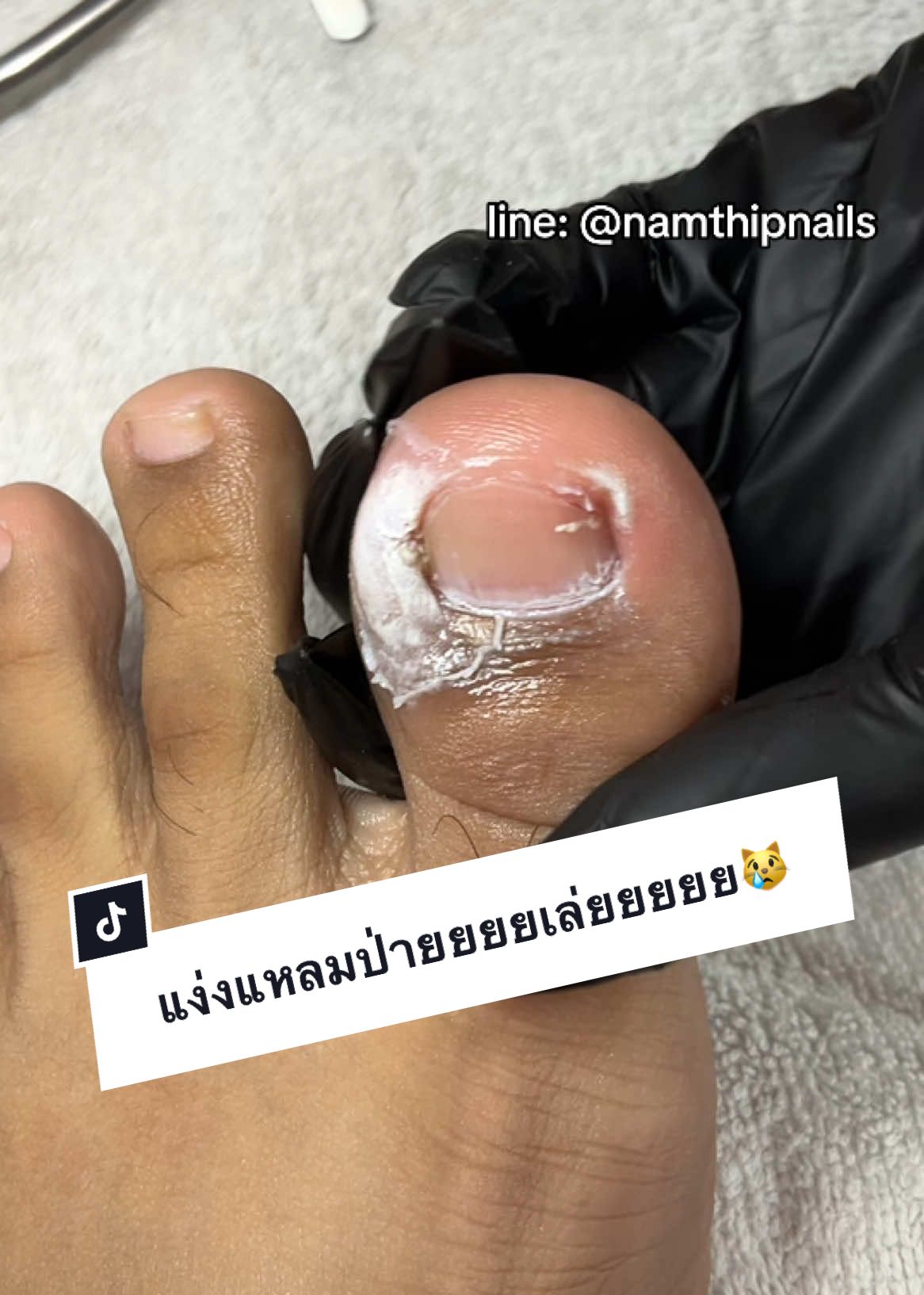 💓 #namthipnails #ตัดเล็บขบ #ตัดหนัง #ทำเล็บ #ร้านตัดเล็บขบ #ร้านตัดเล็บขบราม2 #ตัดเล็บ #เล็บขบ  #เล็บเชื้อรา Fb : namthipnails  Line : @namthipnails  นัมเบอร์วัน8 ตลาดม.ราม2  กทม  Map: namthipnails  https://goo.gl/maps/JmwpCKLfKwmhKGK96  ร้านเปิดทุกวัน เวลา12.00น-22.00น.