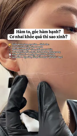 Cơ nhai to bạnh quá thì sao xinh ? 1🍠5 Botox gọn hàm có ngay gương mặt vline #Macademy #mayspa #botox_gọn_hàm #filler_botox_uy_tín 