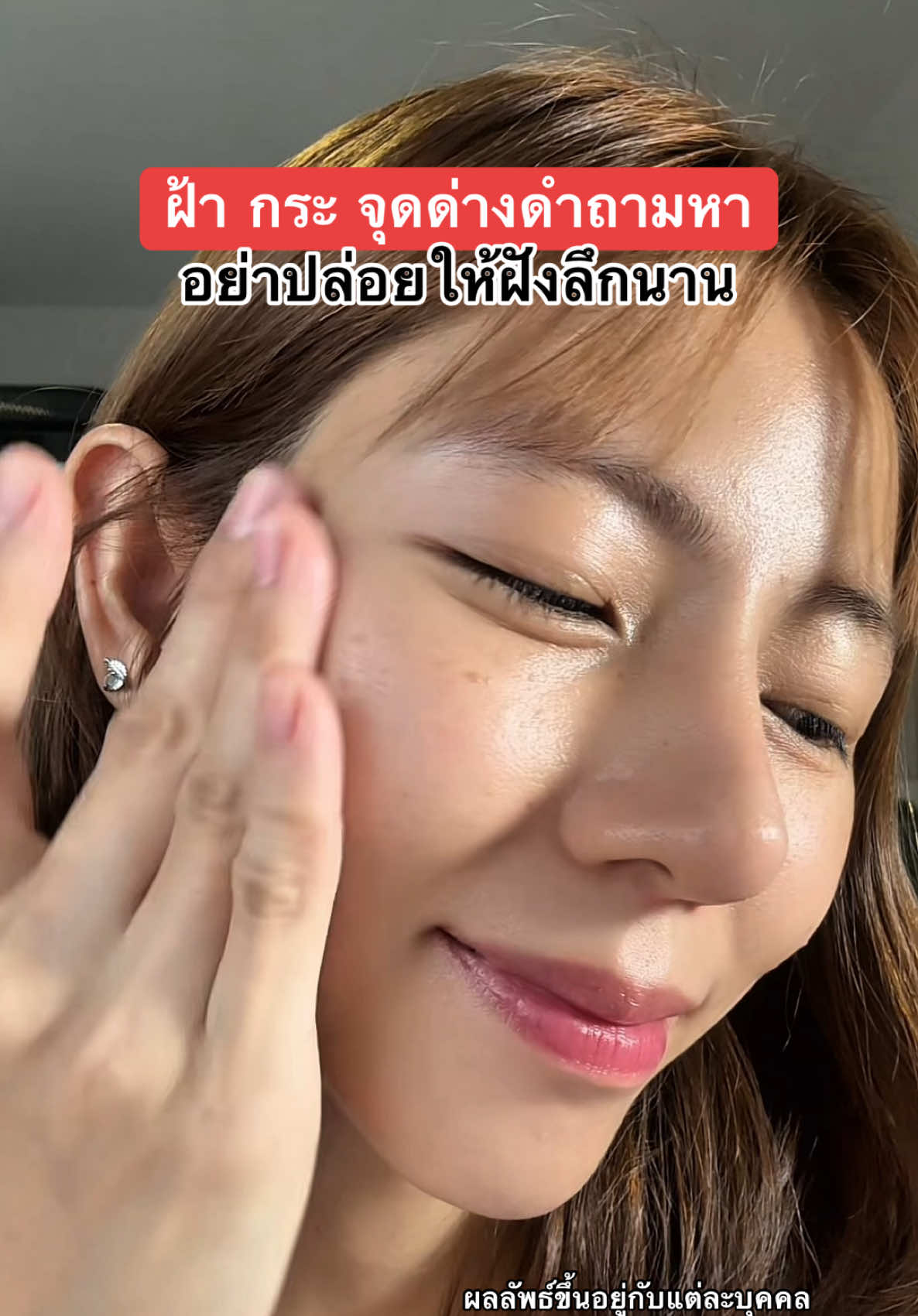 ฝ้ากระเริ่มขึ้น…อย่ารอให้มันฝังลึก  #ฝ้ากระจุดด่างดํา #ผิวเรียบเนียน #p#papafeelpapafeelth #papafeel577