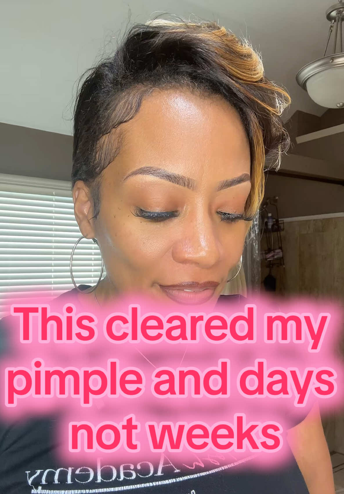 This $7 serum from @The Ordinary clears acne, unclogs pores, and smooths texture FAST. Add it to your routine, your skin will thank you. #TheOrdinary #SalicylicAcid #ClearSkinTips #SkincareRoutine #AcneSkincare #TextureFix #AffordableSkincare #TikTokMadeMeBuyIt #SkincareUnder10 #GlowUpSkincare