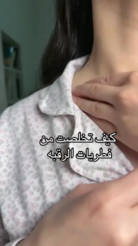#فطريات #فطريات_جلدية #الفطريات #فطريات_الاصابع #عناية_بالجسم #عناية_الجسم #عناية_بالبشرة #عناية #عناية_شخصية #عنايه_بشره #صحة #صحة_المرأة #صحة_عامة #صحة_الجلد #اهتمام #اهتمامي #اهتمامات_بنات 