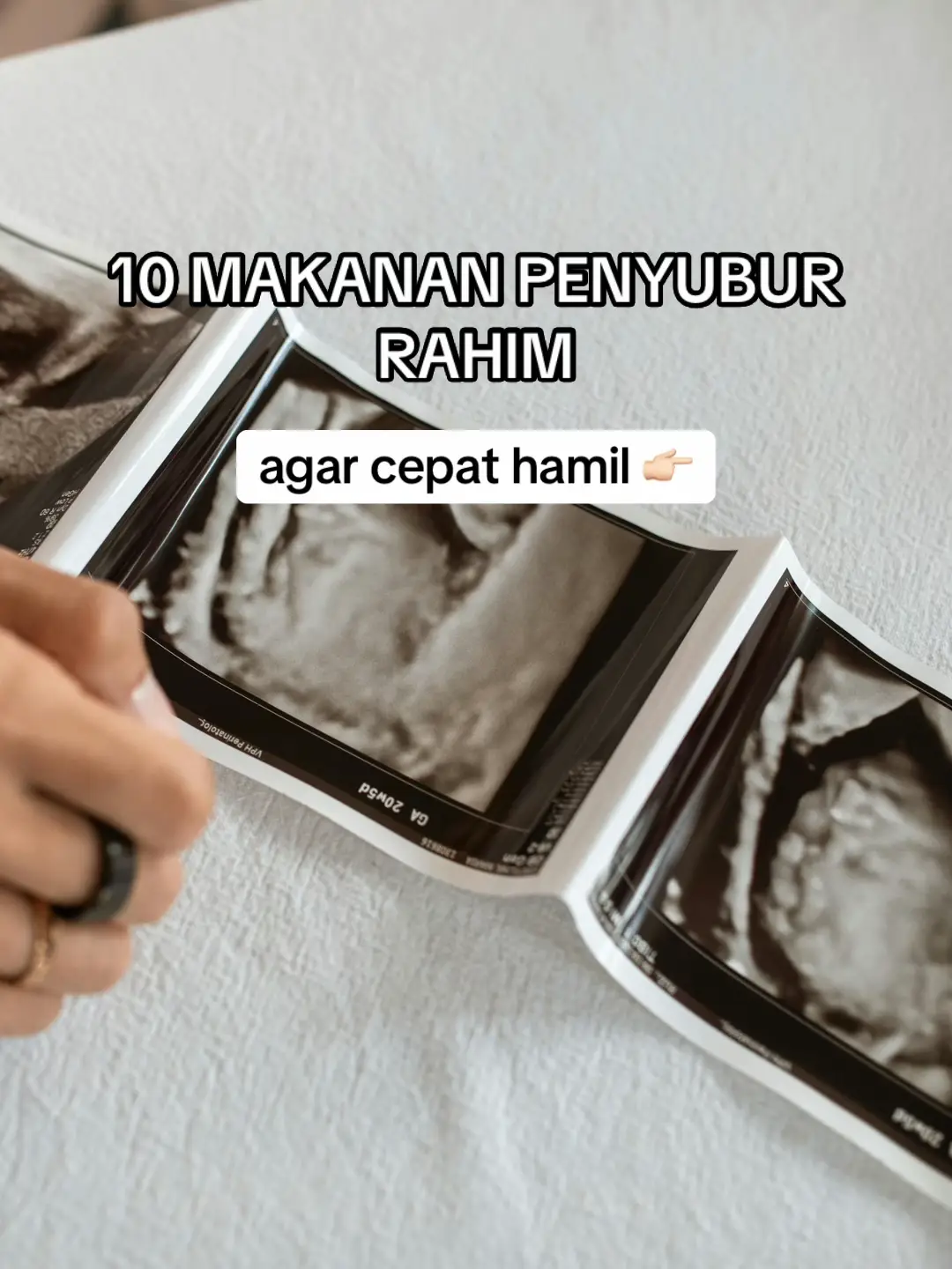 Perbanyak konsumsi makanan diatas dan jangan lupa diimbangi dengan usaha, ikhtiar, dan doa. Klik like, save dan share VT ini jika ilmunya bermanfaat dan jangan lupa follow akun ini untuk dapatkan tips kehamilan selanjutnya! SEMANGAT PEJUANG GARIS 2!!! 🤍✨ #tipspromil #pejuanggarisdua #tipshamil 