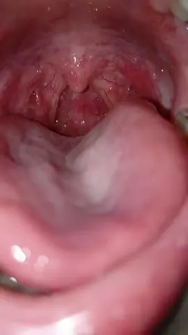 #promomakanliburan #promomakanliburan #smoothlips #Tongue #fypシtiktoktrending #coco #oral 