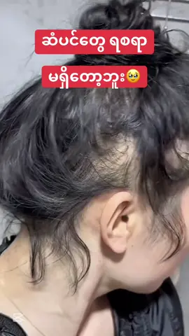 #ဆံပင်တွေငိုချင်လောက်အောင်ကျွတ်နေလား #ဆံပင်ပေါက်ဆေး #အဝါရောင်ဆေးရည် #အမွှေးပေါက်ဆေး #အာမခံccအမွှေးပေါက်ဆေး #အမွှေးသန်ဆေး #အမွှေးထူဆေး #ccbiohair #fyp #ccbrand #biohair #fypage #doublehotbiohairserum #fypပေါ်ရောက်စမ်း #ငါသေမှပဲfypပေါ်ရောက်မှာလား😑😑 #fypပေါ်ရောက်စမ်း😒👊🏻မရောက်လည်းနေ🥴 #fypပေါ်ရောက်စမ်းကွာ #foryoupage #foryou #foryoupageofficiall #tiktok #tiktokuni #trending #tiktokmyanmar #trend #view #viewer #viewတွေရှယ်ကျ #မဖလုတ်နဲ့ကွာ☹ #မflopပါနဲ့ပလိစ့်🥺💓 #thankb4youdo #capcut #မြင်ပါများပီးချစ်ကျွမ်းဝင်အောင်လို့🤒🖤 #ဆယ်လီမှအသဲပေးတာလား😔😑 #တွေးပြီးမှတင်ပါ 