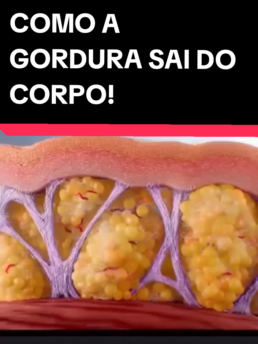 #gorduralocalizada #eliminargordura #emagrecer #emagrecercomsaude 
