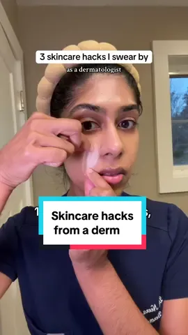 Retinol is not just for your face #smilelines #wrinkles #glycolicacid    #CapCut 
