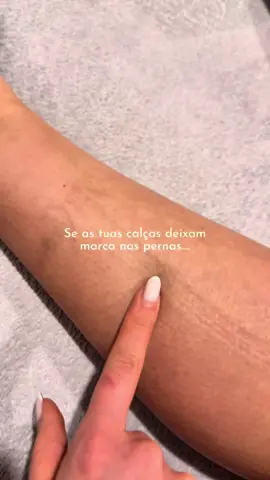 Marcas das calças nas pernas? Não, não é normal... Se ao final do dia reparas que as tuas leggings, meias ou calças deixam marcas profundas na pele… o teu corpo está a tentar dizer-te algo. Este sinal pode ser indicador de má circulação, retenção de líquidos, inflamação silenciosa ou até mesmo Lipedema.   ❌ Não ignores. Não normalizes. Não acredites que é “só cansaço” ou “porque bebi pouca água”. O teu corpo merece mais do que ser suportado — merece ser compreendido e cuidado com atenção. Quando entendes os sinais que ele te dá, consegues agir de forma eficaz. Se te identificas com isto, guarda este vídeo e procura ajuda profissional! #beautyprime #lipedema #macirculacao #retencaodeliquidos #inflamacao