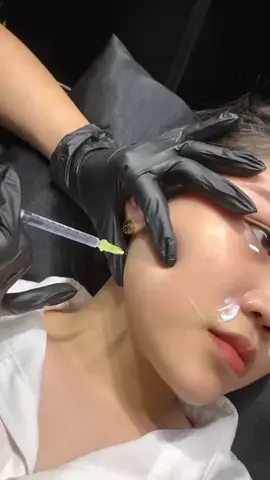 Botox mĩ chuẩn thon gọn hàm ,💉 tiêm 1 lần duy nhất giảm gọn luôn .Bà nào mà hàm to thì nên tiêm và tiêm ngay nhé .Uy tín luôn ạ 😍 - Khi tiêm KH được tư vấn .Đo tỉ lệ chuẩn tổng thể gương mặt -Tư vấn dựa trên Shape riêng của từng KH -Lựa chọn filler phù hợp về Chất Lượng - Giá Cả Julia Aesthetic & Academy Address : Bac Giang Open Daily : 10:00Am - 8:00Pm Hotline: 0868-170-222 NHẬN LÀM TẠI NHÀ !