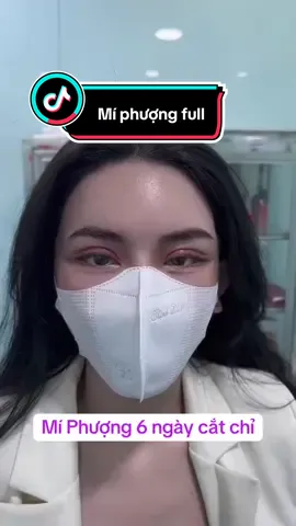 Mí phượng hoàng bay bay của chị e đây nè.. guu bà nào đây ạ #cắt_mí_phượng #hồchíminh #beautyjourney #fypシ #xuhuong #cắt_mí_đẹp #dr_halee #xu_hướng_làm_đẹp #mắtđẹpmíđẹp 