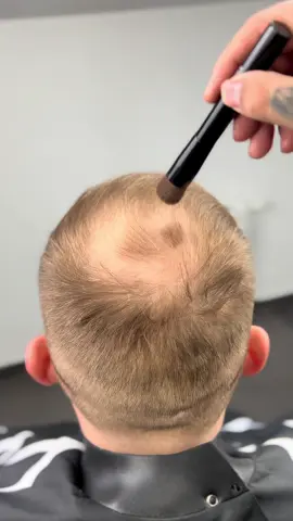 THICK FIBER Root Touch Up powder for thin & Bald spots #hairfibres #thickfiberhair #roottouchup #hairline #rootcoverup #hairpowder #hairlinepowder #hairthickener 