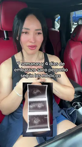 Hoy me dijeron que el saco se ve pequeño, que no parece un embarazo normal… pero yo vi el latido de mi bebé. Fueron palabras duras, lo sé, pero no me voy a rendir. Porque donde otros ven dudas, yo veo esperanza. Ese pequeño corazón latiendo a 148 me recordó que Dios tiene la última palabra, no los médicos ni las medidas. A ti que también estás viviendo incertidumbre: agárrate de la fe, como lo estoy haciendo yo. El tamaño del saco no define el milagro que está creciendo dentro de mí. 🌈 Si hay vida, hay promesa. Y yo me aferro a esa promesa. 🙏🏼 #ProyectoBebé #SacoGestacionalPequeño #LatidoPresente #FeInquebrantable #SemanaAsemana #Esperanza #DiosTieneElControl #Confía 