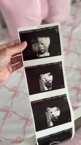 Heard we were sharing our baby’s cutest ultrasound and we had our 3D ultrasound today of babygirl #3dultrasound #fyp #foryoupage #pregnant 