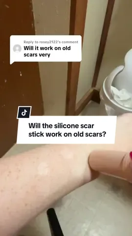 Replying to @rosey2122 will the silicone scar stick work on old scars? #scarstick #scarsolutions #scartreatment #siliconescartape #acnescars #scars #tiktokshopcreatorpicks #dealsforyoudays #skincare @Prequelskin 