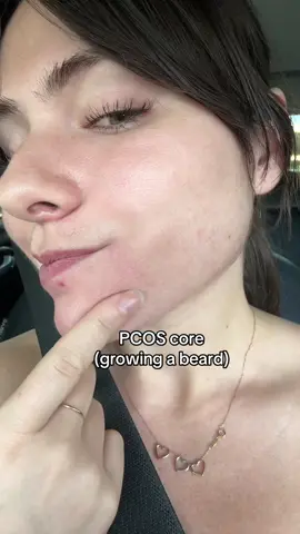 I HATE PCOS!! Having PCOS means chronic hormonal imbalances that make you grow a beard and other body hair in masculine places. This is called hirsutism and most women with PCOS experience it, but not everyone! #pcos #pcosawareness #pcosproblems #pcoslife #pcoswarrior #hirsutism 