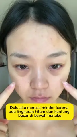 👀 Say goodbye to panda eyes! Smooth out eye bags, fight back dullness, and wake up bright eyes in 28 days~