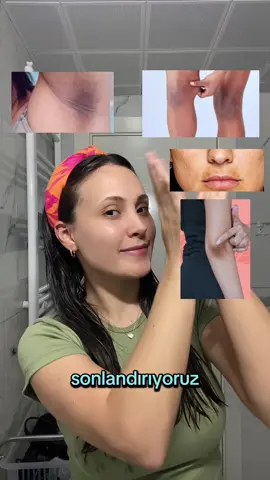 Vücut kararmalarından şikayetçi olan herkesin tanışması gereken o tonik 👉🏻 @Juvera Cosmeceuticals 🩵 #isbirligi reklam #vücutkararmaları #ciltbeyazlatma 