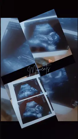 ❤️🤰🏻