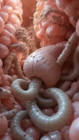 Tapeworms and Roundworms | 3D Look Inside the Human Gut #3D #animation 