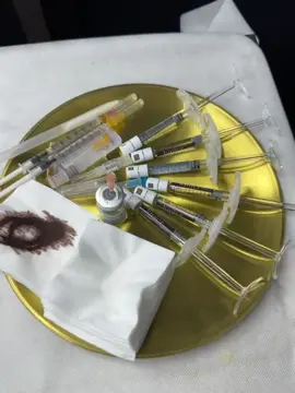 Chỉnh fullface💉💉💉