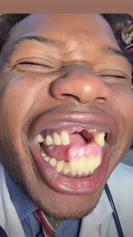 Asmr be like🤣 #fypシ゚viral #fyp #fypシ #funnyvideos #viral #comedyvideo #tiktok #funny #fyppppppppppppppppppppppp #asmr #damm #teeth #toothless 