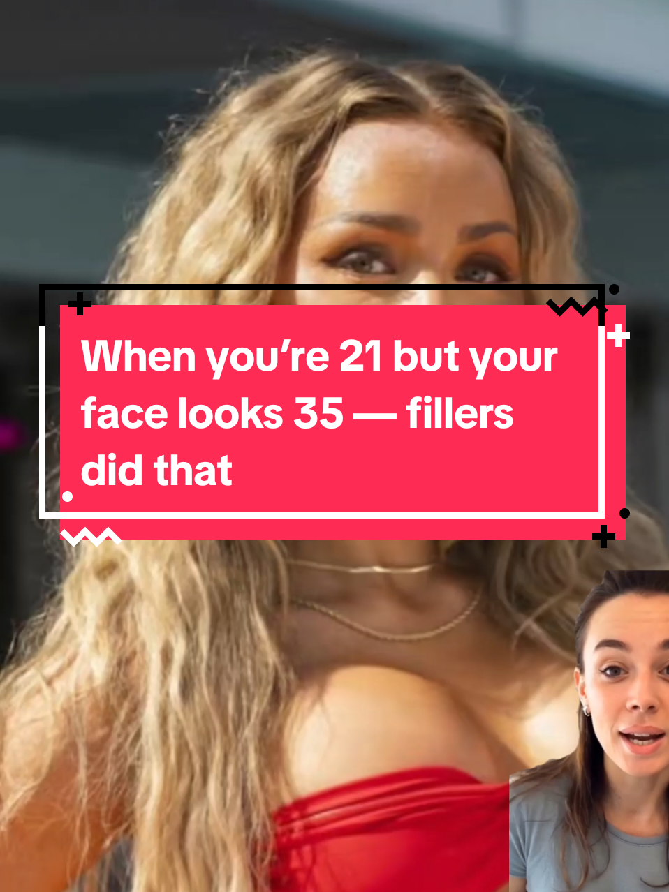 #loveislandusaseason7 #loveislandusa #fillers #vanna #botox 