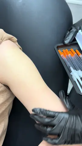 Botox thon gọn bắp tay – Giải pháp “cứu cánh” cho tay to, thô dù đã hút mỡNhiều chị em sau khi hút mỡ bắp tay nhưng vẫn thấy tay to, cứng và “lực sĩ”? Đó là do cơ bắp phát triển mạnh, khiến vùng tay khó đạt được độ mềm mại, thon thả như mong muốn.Giải pháp: Tiêm Botox thon gọn cơ bắp tay✅ Làm mềm cơ, giúp bắp tay gọn gàng hơn✅ Không cần can thiệp phẫu thuật✅ Kết quả tự nhiên – tay thon, nhỏ, phẳng mịn và nữ tính hơn thấy rõ👉 Inbox ngay để được tư vấn chi tiết – không cần đau đầu chọn áo che khuyết điểm nữa, vì tay đã đẹp sẵn rồi 💉