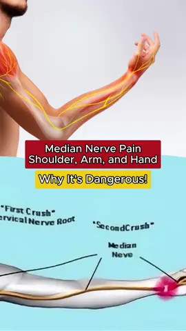 Median nerve pain in shoulder arm and hand #pain #symptoms #healthtips #cause #medical #body 