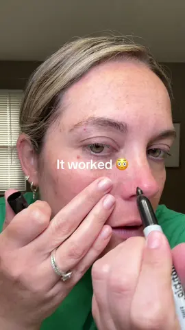 Dr Melaxin peel shot literally removes anything! #peelshot #drmelaxin #dealsforyoudays 