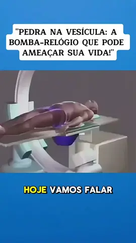 #vesicula #saude #cuidados #qualidadedevida 