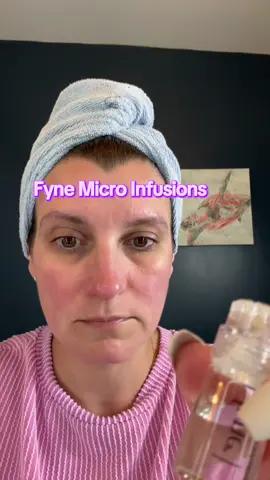 Admittedly scared to try this, but it wasn’t painful. You get 6 treatments with this set and you do a treatment every 2-4 weeks #microinfusionfacial #microinfusion #faceserum #skincare #antiaging #fynebeauty 
