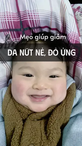 Mùa hè cũng nên dưỡng ẩm cho da con nha mấy bà #dizigone #kemduongamchobe #kemduongamdizigone #mevabe #chamsocembe 