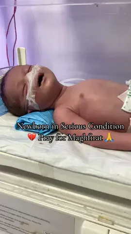 Newborn Baby in Final Moments Please Pray 💔🙏 #NewbornBaby   #CriticalCondition   #FinalMoments   #PleasePray   #Maghfirat   #TinySoul   #InAllahsHands   #DuaForBaby   #NICUBaby   #YaAllahReham   #LittleAngel   #GoneTooSoon   #BabyInNICU   #PrayForPeace   #JannatForBaby