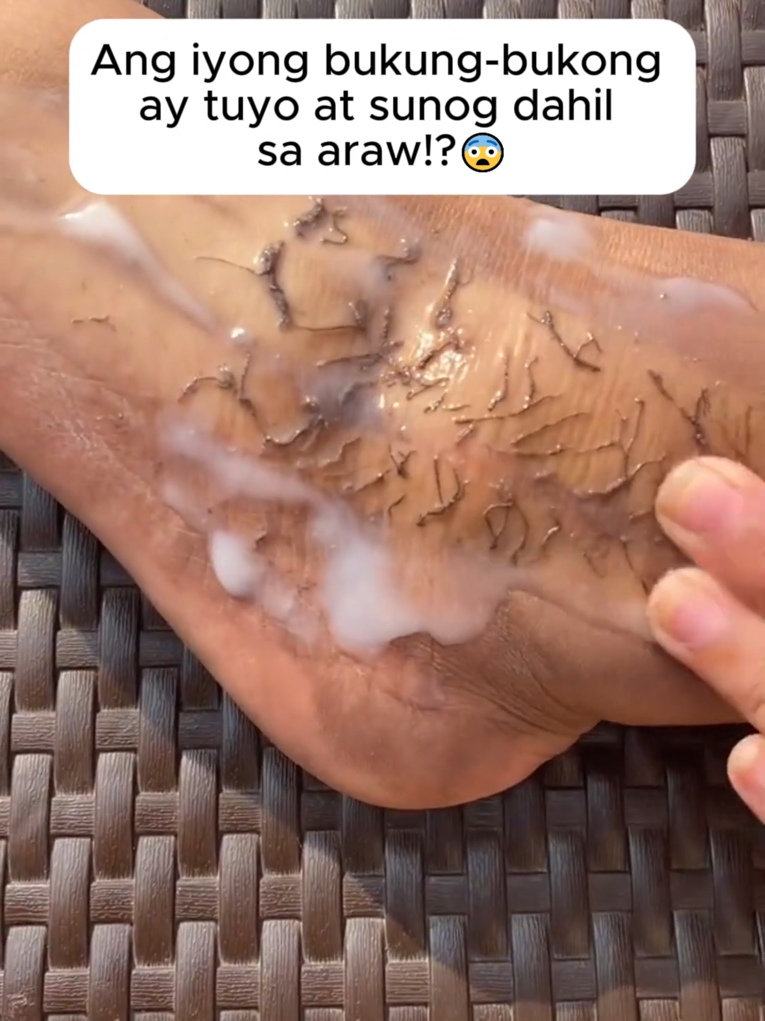 🎯 Whiten Skin After 3 Days - No Sun Exposure, No Darkening With Japan's No. 1 5in1 Exfoliator 💥 Only Today! BUY 3 FREE 3 #niacinamideexfoliatingwhiteninggel #amandaessentials #whitenning #skincare #exfoliatinggel