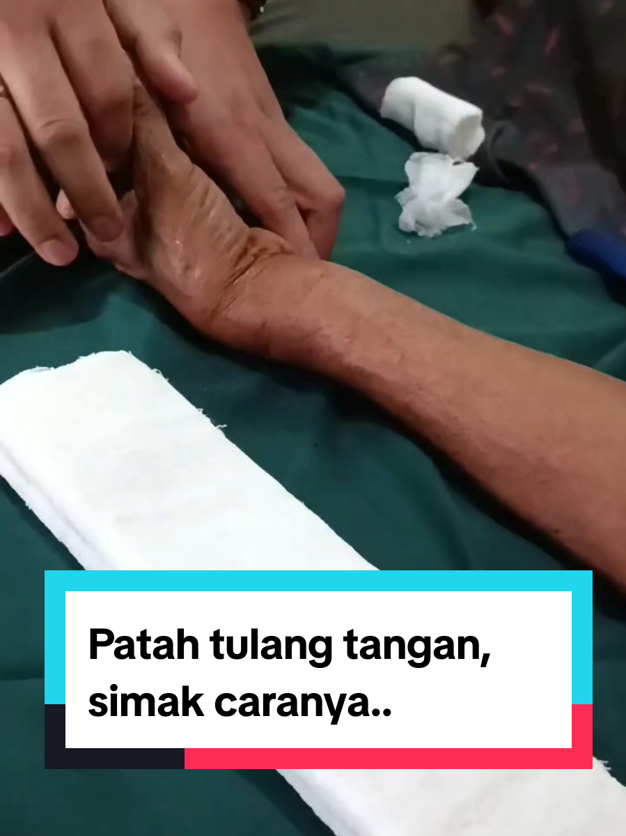 Kasus patah tulang tangan, Alhamdulillah bisa direposisi oleh tim yanmu.. tinggal masa perawatan dan masa penyambungan.. mau bisa bantu banyak orang untuk kasus cedera tulang.. yuk cek dlink bio...belajar dan pahami ilmunya.. . . . . #sangkalputung #dislokasisendi #patahtulang #keseleo #terkilir #cideratulang #tulangpatah #viral #bsp  #pengobatan #tradiosonal #acl #dislokasi #fyp #tiktok  #pengobatantradiosonal #pengikut #sorotan #sangkalputungbudi #tulangpatah #tulangbengkok #yanmu #kaderyanmu #intiraga