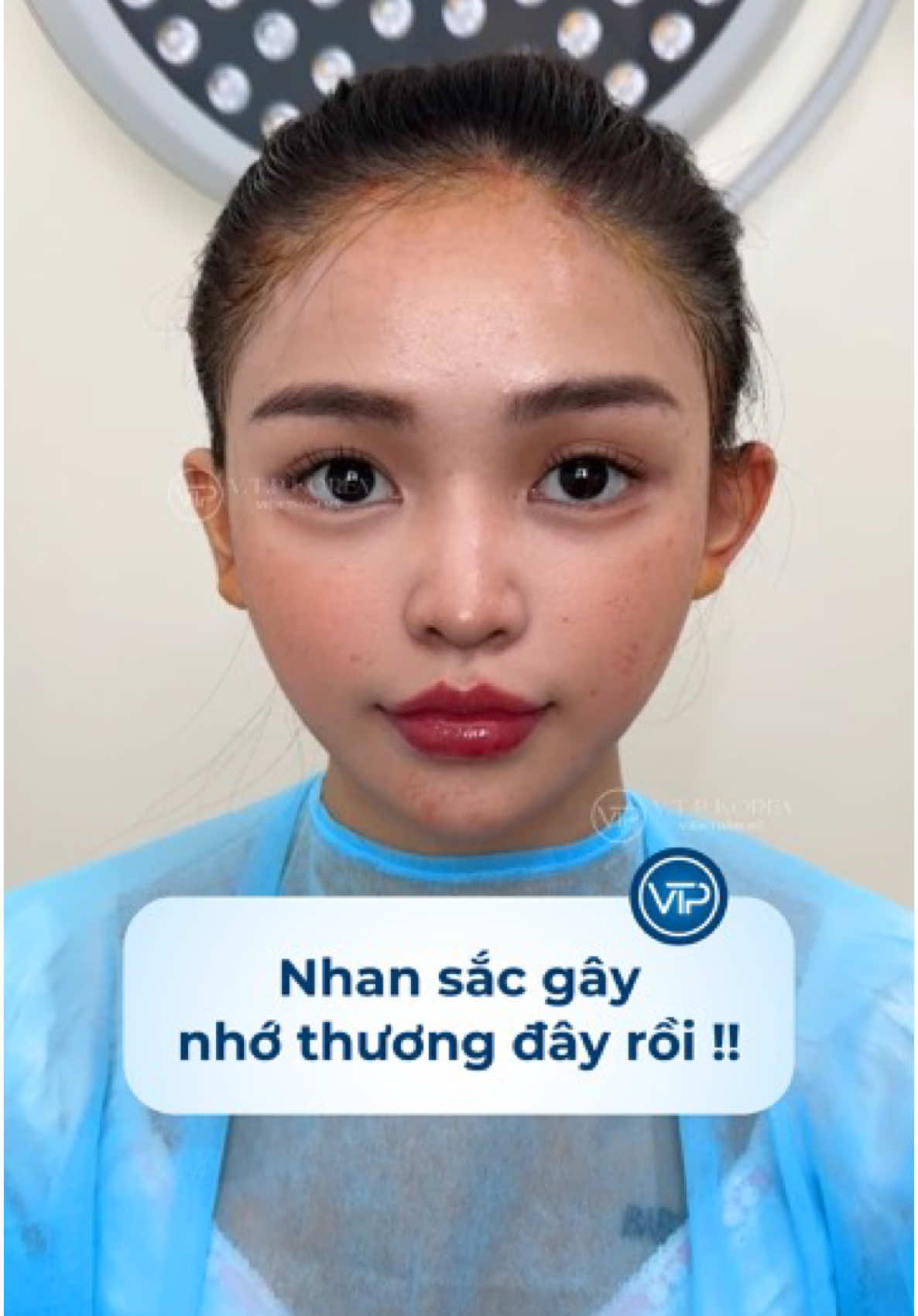 Nhan sắc gây nhớ thương đây rồi❗️#xuhuong #trending #thammy #cangco #vuthiphung #phungmelamdep #vtpkorea #canchinhfullface 