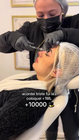 Ãmo! 😍😋 #fyp #harmonizacaofacial #preenchimento 