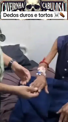 Dedos tortos ☠️⚰️ #idosos #doenca #artrite #saude #dor #medico #ortopedia #ortopedista #hospital #juntas #ossos #medicina