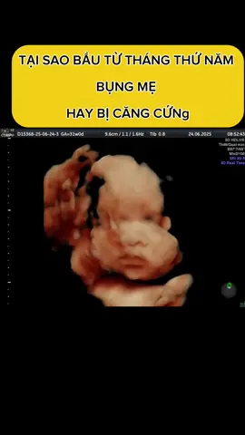 Từ tháng thứ 5 mẹ hay căng cứng bụng #mebauvaembe #mangthai #landaulamme #mebau #mebauthongthai #embedangyeu #embe #sieuamthai #xuhuong #nhungdieucanbiet #viraltiktok #xuhuongtiktok 