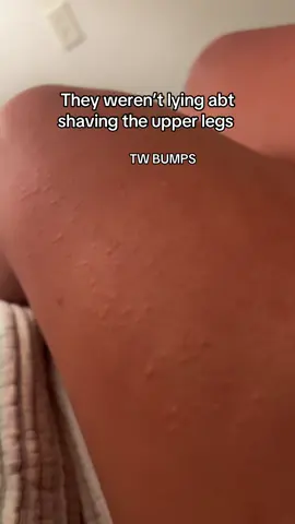 #razerburn #o #THIS #shit #hurts #thishurts #yes #fypシ 