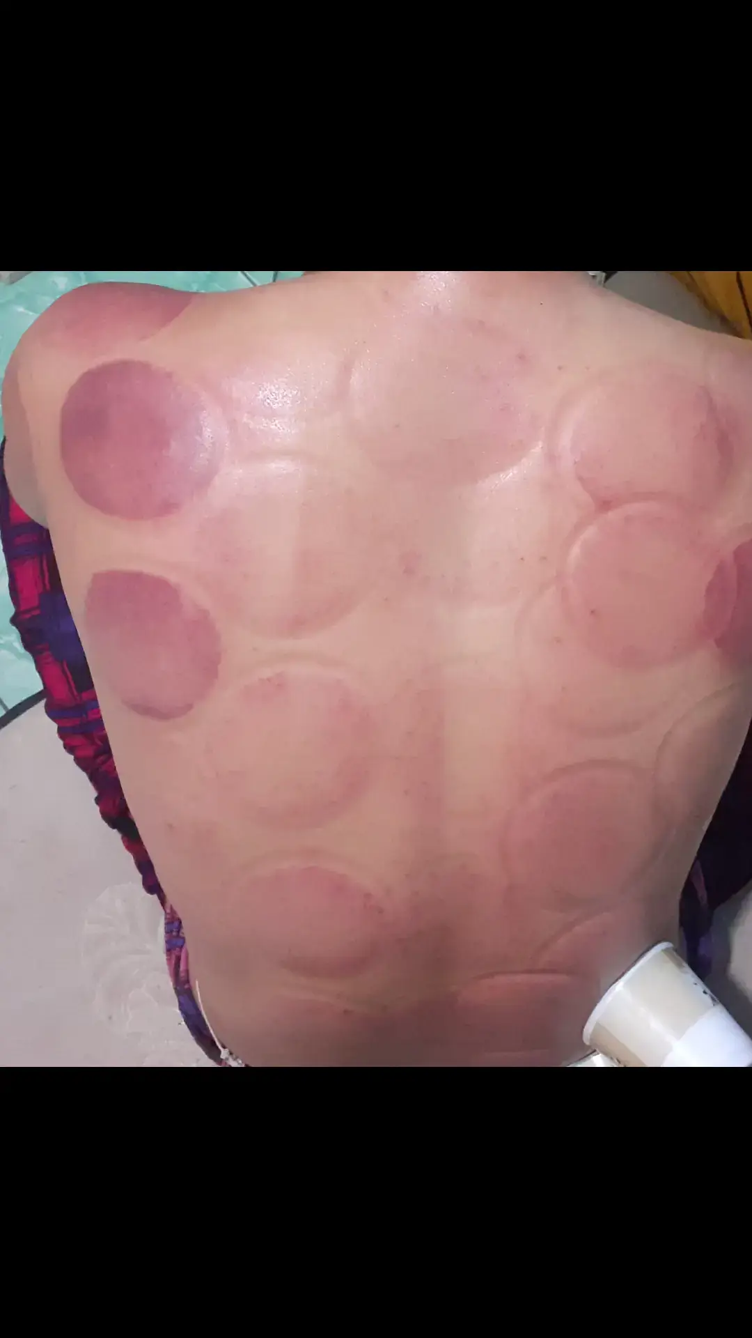 gk usah fyp#sakit #meriang #merindukan #kasihsayang 