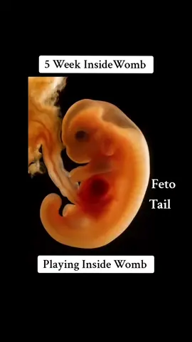 5 weeks baby playing Inside the womb #PregnancyJourney #PrenatalHealth #babyinsidemomsbelly #babyinsidebelly #babyinsidemytummy #babyinsidemomsbelly #babyinsidewomb❤️ #babyinsidemytummy #5weekspregnant #5weeksold #5weeksearly 