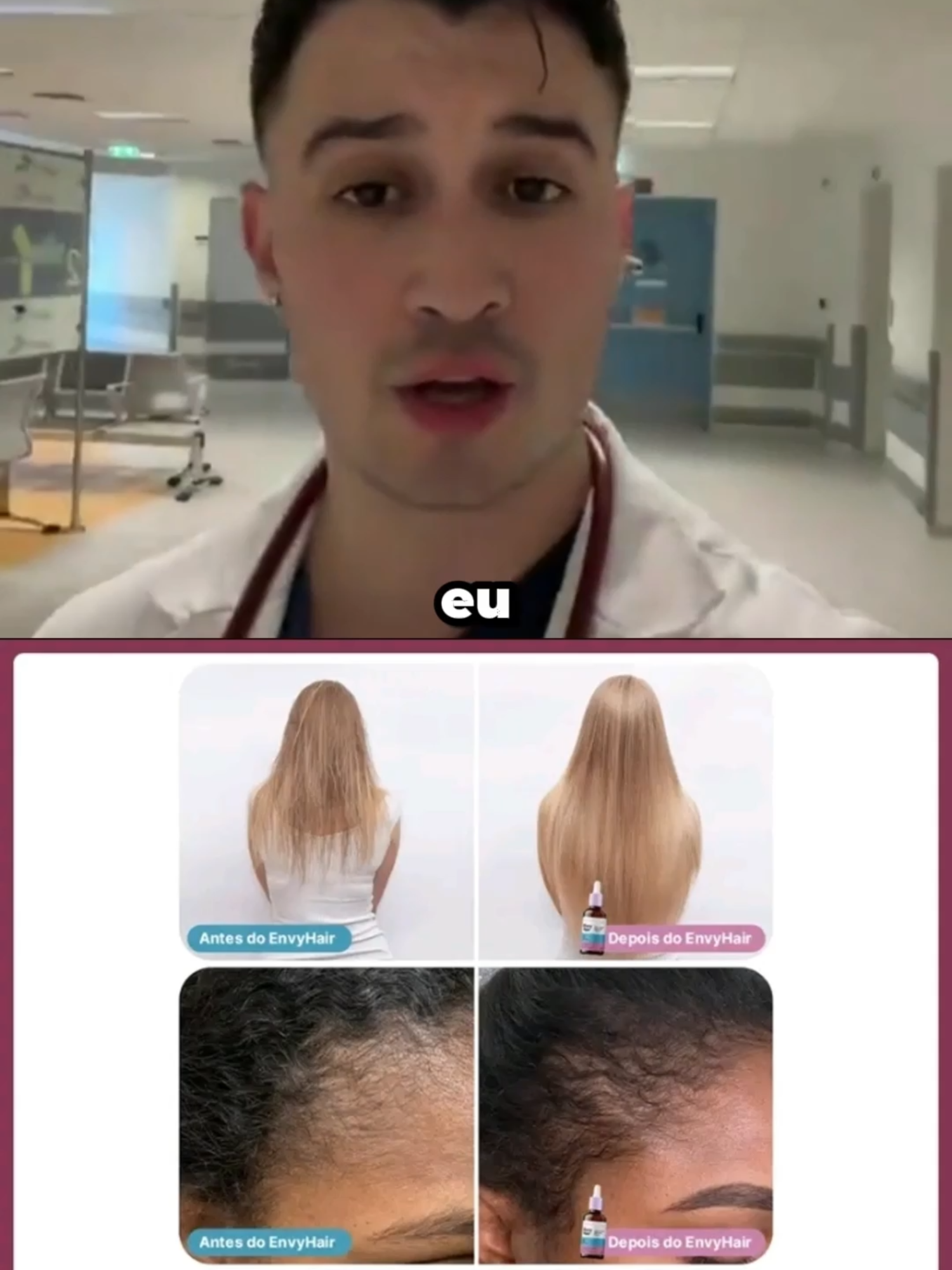 #TikTokShop #tiktokshopchegou #tiktokshopbrasil #fyppp #prosperidade #cabelo #cabelos