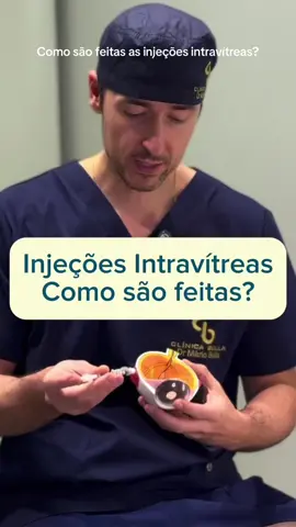 💉 Você sabia que existe um tipo de tratamento ocular feito com injeções diretamente dentro do olho? Parece assustador, mas pode ser a salvação da visão para muitas pessoas! As injeções intravítreas são um dos principais tratamentos utilizados hoje em dia para doenças graves da retina, como a degeneração macular relacionada à idade (DMRI), o edema macular diabético e até complicações da retinopatia diabética. Muita gente se assusta só de ouvir “injeção no olho”, mas a verdade é que o procedimento é bem mais simples e rápido do que parece. É feito com anestesia local (geralmente em forma de colírio), em ambiente estéril, e leva apenas alguns minutos. O olho é cuidadosamente preparado com antissépticos, a anestesia é aplicada, e a injeção é feita com uma agulha extremamente fina, que praticamente não causa dor. O paciente não vê a agulha chegando, o que também ajuda muito na tranquilidade durante o procedimento. O mais importante é entender que esse tipo de tratamento é fundamental para preservar a visão e evitar a progressão de doenças que, se não tratadas, podem levar à cegueira. Se você ou alguém próximo está passando por esse tipo de tratamento, saiba que está em boas mãos. Com acompanhamento adequado, os resultados podem ser excelentes! #Retina #Visão #InjeçãoIntravítrea #DegeneraçãoMacular #RetinopatiaDiabética #EdemaMacular #TratamentoOcular #SaúdeOcular #Oftalmologia #RetinaeVítreo