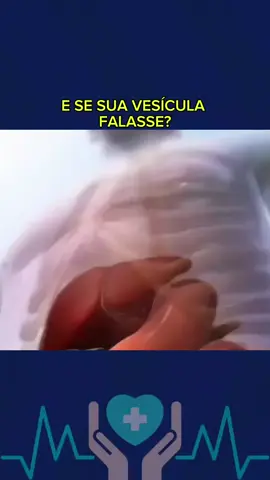 #vesiculabiliar #vesicula #fyyyyyyyyyyyyyyyy #mente #curiosidades #saude #curiosidades #corpo #bemestar #fpy #vaiprofycaramba 